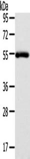 Forkhead Box C1 antibody, TA350668, Origene, Western Blot image 