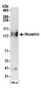 Nicastrin antibody, A304-464A, Bethyl Labs, Western Blot image 