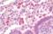 Zinc Finger Protein 398 antibody, orb73389, Biorbyt, Immunohistochemistry paraffin image 