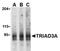 Ring Finger Protein 216 antibody, SP2172P, Origene, Western Blot image 