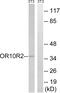 Melanoma-associated antigen 5 antibody, GTX86999, GeneTex, Western Blot image 