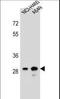 Dehydrogenase/Reductase 4 Like 1 antibody, LS-C167399, Lifespan Biosciences, Western Blot image 