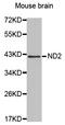 NADH-ubiquinone oxidoreductase chain 2 antibody, LS-B15632, Lifespan Biosciences, Western Blot image 