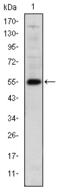 LIM Homeobox 2 antibody, M05940, Boster Biological Technology, Western Blot image 