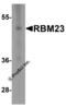 RNA Binding Motif Protein 23 antibody, 8611, ProSci, Western Blot image 