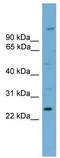 Homeobox protein Hox-B7 antibody, TA342268, Origene, Western Blot image 