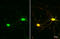 Solute Carrier Family 17 Member 7 antibody, GTX133148, GeneTex, Immunofluorescence image 