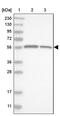 Leucine Zipper And EF-Hand Containing Transmembrane Protein 2 antibody, PA5-55209, Invitrogen Antibodies, Western Blot image 