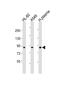 Coagulation Factor II, Thrombin antibody, M00044-1, Boster Biological Technology, Western Blot image 