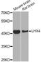 LIM Homeobox 4 antibody, A8072, ABclonal Technology, Western Blot image 