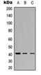 5'-Nucleotidase, Cytosolic IA antibody, orb315806, Biorbyt, Western Blot image 