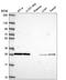 Coagulation Factor III, Tissue Factor antibody, HPA069132, Atlas Antibodies, Western Blot image 