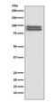 Forkhead Box P1 antibody, M00723, Boster Biological Technology, Western Blot image 