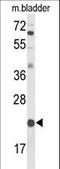 DiGeorge Syndrome Critical Region Gene 6 antibody, LS-C167381, Lifespan Biosciences, Western Blot image 