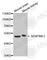 Serpin Family E Member 2 antibody, A5329, ABclonal Technology, Western Blot image 