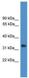 WD Repeat Domain 5 antibody, TA345998, Origene, Western Blot image 