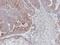 Mitogen-Activated Protein Kinase 9 antibody, GTX105523, GeneTex, Immunohistochemistry paraffin image 