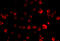 Poly(RC) Binding Protein 4 antibody, A11870, Boster Biological Technology, Immunofluorescence image 