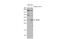 Snail Family Transcriptional Repressor 2 antibody, GTX128796, GeneTex, Western Blot image 