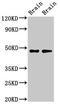 Corticotropin Releasing Hormone Receptor 2 antibody, CSB-PA623797LA01HU, Cusabio, Western Blot image 