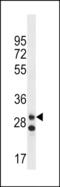 Leucine Rich Repeat Containing 3C antibody, PA5-49117, Invitrogen Antibodies, Western Blot image 