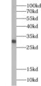 GRB2 Related Adaptor Protein antibody, FNab03634, FineTest, Western Blot image 