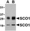 SCO Cytochrome C Oxidase Assembly Protein 1 antibody, orb74803, Biorbyt, Western Blot image 