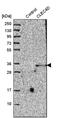 C-Type Lectin Domain Family 4 Member D antibody, PA5-52131, Invitrogen Antibodies, Western Blot image 