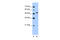 Proline Rich 5 Like antibody, 29-781, ProSci, Enzyme Linked Immunosorbent Assay image 