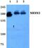 Neurexin-3-alpha antibody, PA5-37189, Invitrogen Antibodies, Western Blot image 