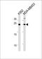 Sarcospan antibody, PA5-35287, Invitrogen Antibodies, Western Blot image 