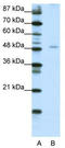 Nuclear Factor I B antibody, TA331122, Origene, Western Blot image 