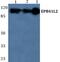 Erythrocyte Membrane Protein Band 4.1 Like 2 antibody, PA5-75478, Invitrogen Antibodies, Western Blot image 