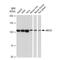 ATP Binding Cassette Subfamily G Member 1 antibody, GTX03242, GeneTex, Western Blot image 