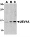 Ubiquitin Conjugating Enzyme E2 V1 antibody, orb74565, Biorbyt, Western Blot image 