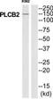 Phospholipase C Beta 2 antibody, TA314345, Origene, Western Blot image 