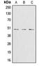 Glutamate-Ammonia Ligase antibody, orb213985, Biorbyt, Western Blot image 