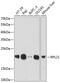 Ribosomal Protein L21 antibody, GTX66241, GeneTex, Western Blot image 