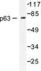 Tumor Protein P63 antibody, LS-C176166, Lifespan Biosciences, Western Blot image 