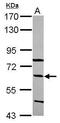 Complement C8 Beta Chain antibody, GTX118877, GeneTex, Western Blot image 