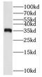 Membrane Spanning 4-Domains A12 antibody, FNab05368, FineTest, Western Blot image 