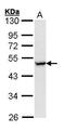 C-C Motif Chemokine Receptor 8 antibody, PA5-34634, Invitrogen Antibodies, Western Blot image 