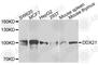 DExD-Box Helicase 21 antibody, A7034, ABclonal Technology, Western Blot image 