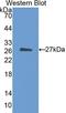 Cholesteryl Ester Transfer Protein antibody, LS-C300631, Lifespan Biosciences, Western Blot image 