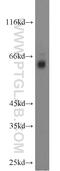 Regulator Of G Protein Signaling 14 antibody, 16258-1-AP, Proteintech Group, Western Blot image 