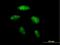 Bromodomain Adjacent To Zinc Finger Domain 2B antibody, H00029994-B01P, Novus Biologicals, Immunocytochemistry image 