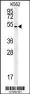 Hedgehog Acyltransferase antibody, 61-955, ProSci, Western Blot image 