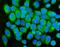 Plectin antibody, PB9430, Boster Biological Technology, Immunofluorescence image 