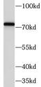 BM-90 antibody, FNab03127, FineTest, Western Blot image 