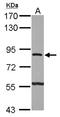 ATPase H+ Transporting V0 Subunit A2 antibody, NBP2-15516, Novus Biologicals, Western Blot image 